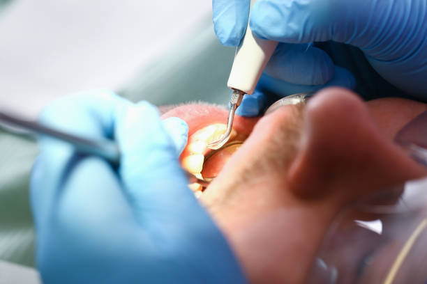 Best Pediatric Emergency Dentist in Moreland Hills, OH
